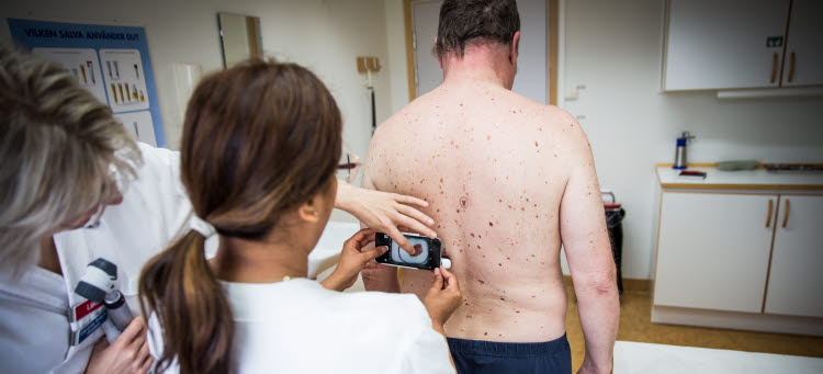 Bild på en man som får huden på ryggen undersökt